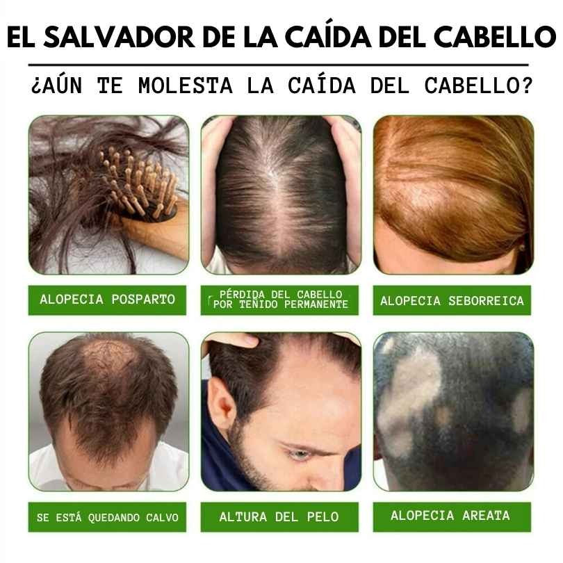 🌿 Serum 7 Days | Estimula el Crecimiento Natural del Cabello (60ml)