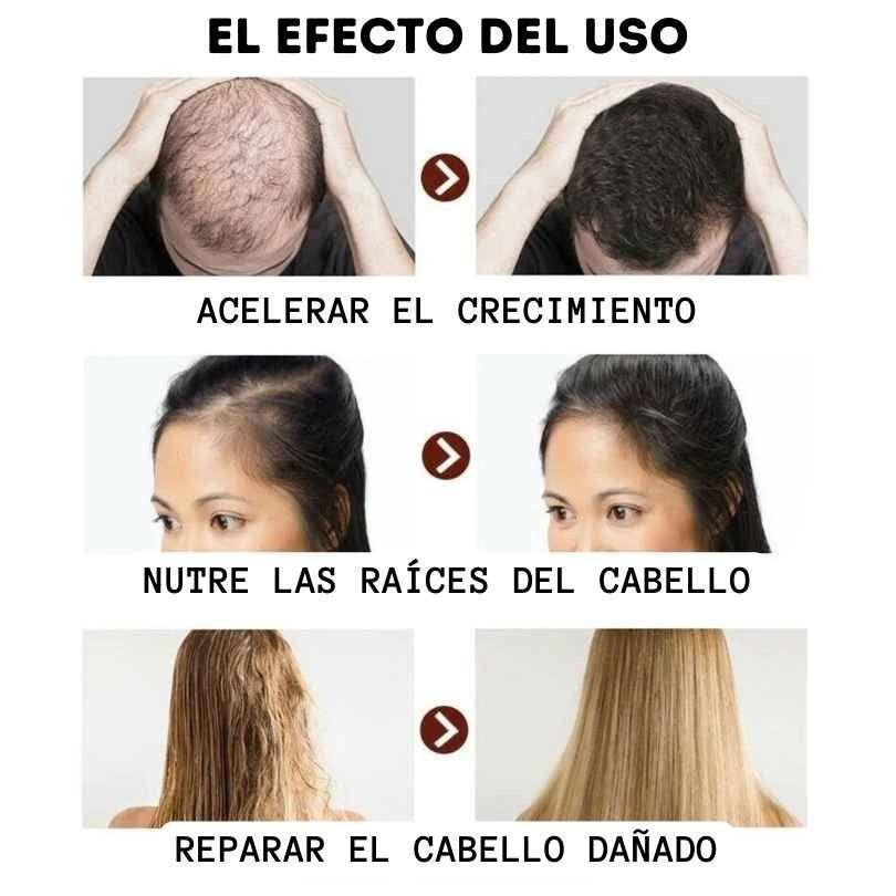 🌿 Serum 7 Days | Estimula el Crecimiento Natural del Cabello (60ml)