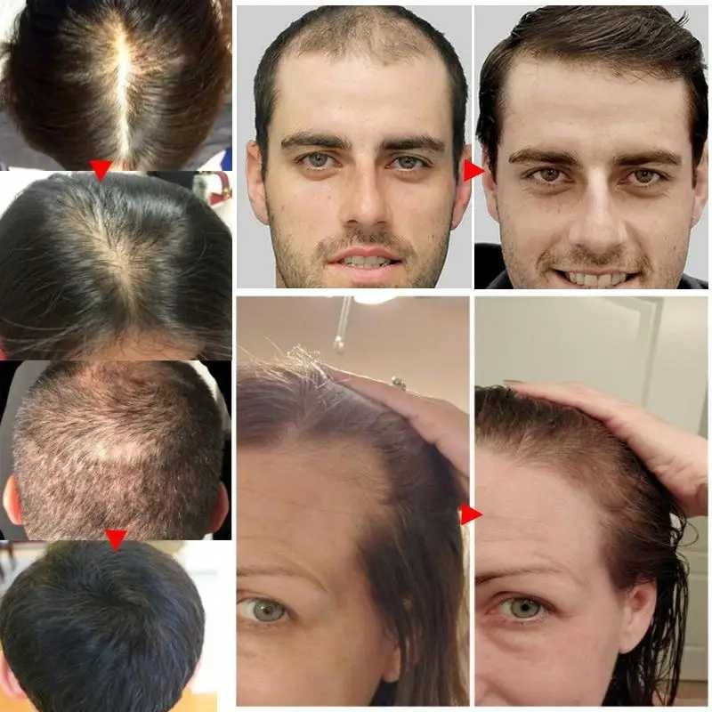 🌿 Serum 7 Days | Estimula el Crecimiento Natural del Cabello (60ml)